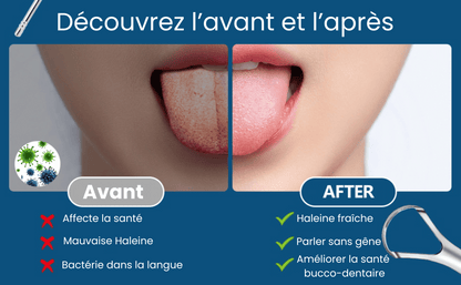 2 Gratte Langue + Un Spray Rafraichissant Offert