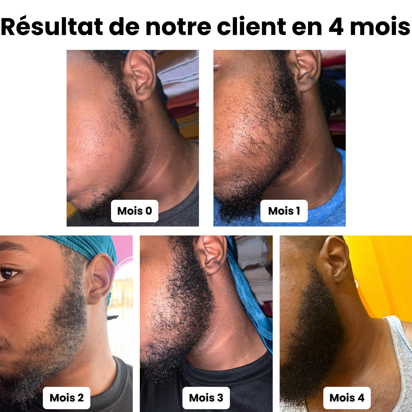 Kit de Croissance pour Barbe – Huile, Crème & Shampoing